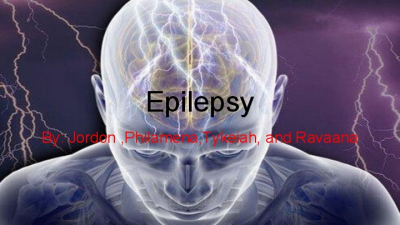 Epilepsy